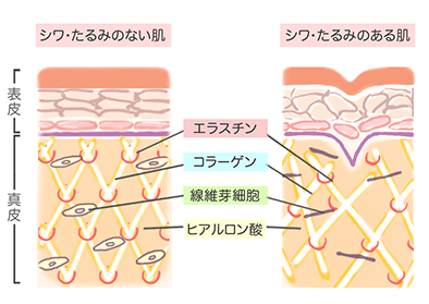 エラスチン